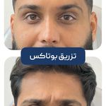 کلینیک زیبایی و جوانسازی پوست و مو الین