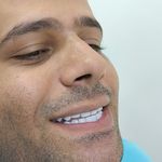 کامپوزیت ونیر