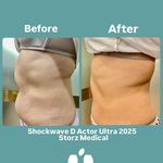 تغذیه و لاغری راز