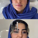 کلینیک زیبایی و لیزر هیرا