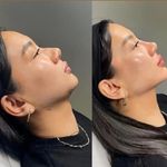 کلینیک پوست و زیبایی ژیلاوَش