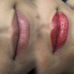 رفع تیرگی لب - اصلاح بدرنگی تتو قدیمی