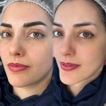 مرکز تخصصی فیبرز ابر‌و حمیده رحیمی