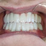 مطب ایمپلنت دکتر نیما شفیعی