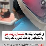 مریم درویشی میکرواسکالپ سر در اهواز