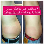 کلینیک زیبایی ،لیزر و لاغری گل مریم