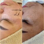 پاکسازی پوست اراک