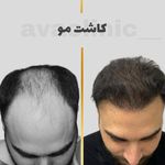 کلینیک تخصصی پوست و کاشت مو آوا