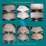 مطب پوست و زیبایی