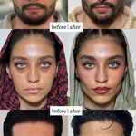 کلینیک پوست،مو،زیبایی،مرکز لیزر ‌پرنسا