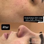 خدمات پوستی میراندا آواک