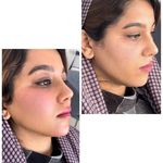 کیلینیک پوست مو زیبایی نیل