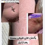 مطب پوست، مو و زیبایی و لیزر شبیرا