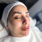 خدمات تخصصی فیشال(مراقبت پوست و مو)ساناز
