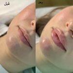مطب زیبایی دکتر نلسا