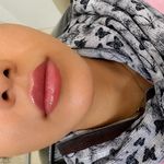 کلینیک تخصصی پوست لیزر و زیبایی آنیل