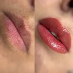 Lilac Spa | مرکز تخصصی پوست و مو