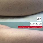 مرکز لیزر وکلینیک زیبایی پایون(بانوان)