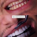 دکتر الهه بداقی، دکترای دندانپزشک