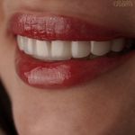 دندانپزشکی دکتر آزاده قاسمی