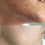 فیشال الا اسکین