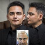 کلینیک پوست مو و زیبایی نوین ایرانا