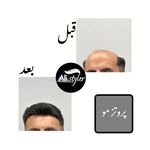 آرایشگاه ،داماد کده علی استایلر