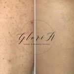 کلینیک زیبایی گلوریا