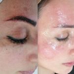 فیشال و خدمات پاکسازی پوست  فاطمه انامی