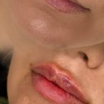 کلینیک زیبایی و مرکز لیزر و لاغری نیکشا