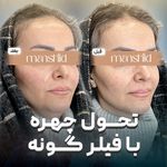 کلینیک زیبایی مانشید