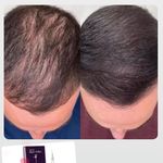 کلینیک پوست و مو و لیزر نیلوفر آبی