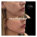 کلینیک زیبایی و لیزر مو زائد نوبا