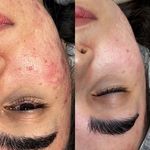 مژگان اسکین کرMojgan skincare