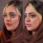 کلینیک پوست مو زیبایی حضور