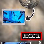 کراتین و اسکراب اسکالپ حانیه شکرانه