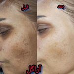 سالن زیبایی آراگل