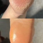 خدمات تخصصی پدیکور درمانی شیوا