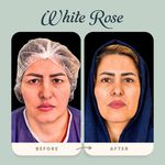 مرکز بلفاروپلاستی فوق تخصصی رز سفید