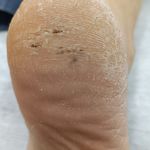 کفسابی و پدولوژی ناخن خانمها و آقایان