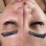 مرکز تخصصی فیشال و پاکسازی پوست حنانه