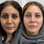 کلینیک پوست مو زیبایی دکتر نینا