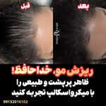 اولین مرکز تخصصی میکرواسکالپ در شرق کشور