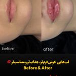 مرکز لیزر و کلینیک زیبایی پریفا