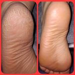 کاشت ناخن پودر و ژل