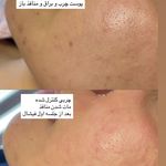 مرکز لیزر ،پوست و زیبایی کندی بیوتی