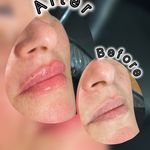 جوانسازی و زیبای فرشته