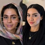 کلینیک ژل بوتاکس لیزر فیل بیوتی