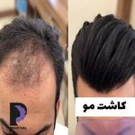 کلینیک زیبایی پوست و مو و لیزر پامچال