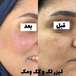 کلینیک پوست مو زیبایی و لیزر کهربا